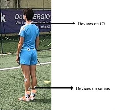 Effects of a proprioceptive focal stimulation (Equistasi®) on reducing the biomechanical risk factors associated with ACL injury in female footballers